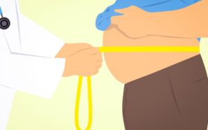 Лечение ожирения в Израиле